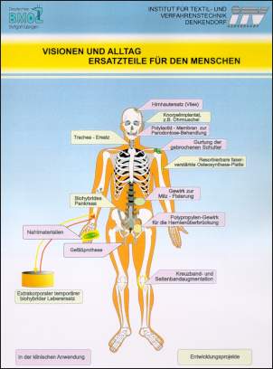 vergrößerte Abbildung